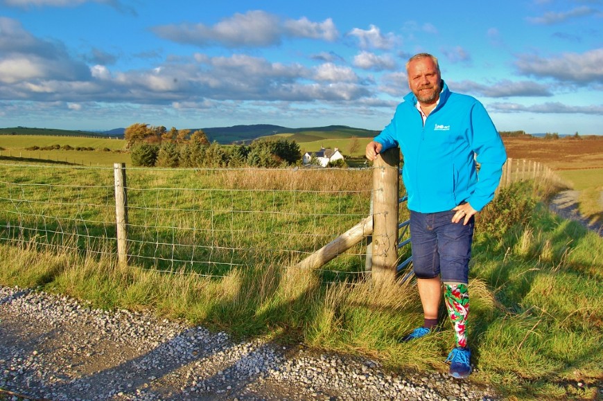 马克·威廉姆斯(Mark Williams)靠在夏日田野旁的一根篱笆柱上，展示着他的假腿上红色和绿色的图案。